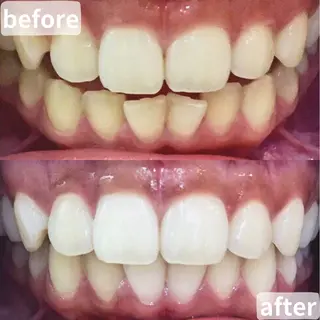 LBSホワイトニング桶川店所属・LBSホワイトニング 桶川店のその他イメージ