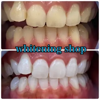 ホワイトニング ショップ千葉店のその他イメージ