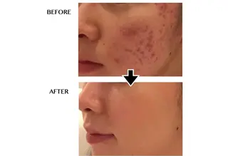 LAGRECE 大阪梅田店のエステ・リラクイメージ