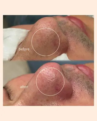 毛穴と脱毛のお店 "Lea" 壷林のエステ・リラクイメージ