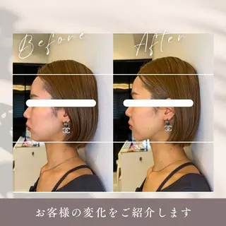 小顔矯正&美容整体 整え屋REDオーナーのエステ・リラクイメージ