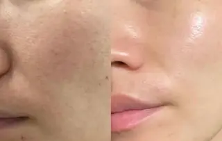 ネイル 愛維美水光美肌専門店所属・愛維美水光美肌専門店 メンズレディースokのエステ・リラクイメージ