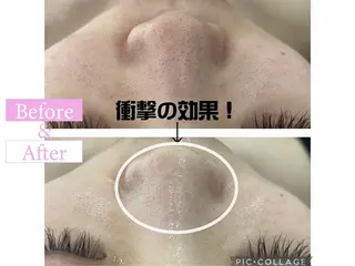 カンナムビューティー 新宿🦋碧.aoiのエステ・リラクイメージ