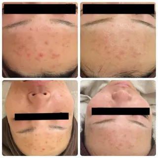 美肌脱毛・ハーブピーリング専門店Larin la beaute所属・Larin la beauteのエステ・リラクイメージ