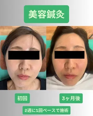 河輪 鍼灸接骨院のエステ・リラクイメージ