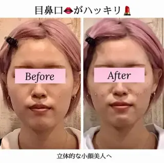 小顔矯正 natsuのエステ・リラクイメージ