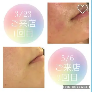 痩身リンパダイエット 隠れ家サロンチャームのエステ・リラクイメージ