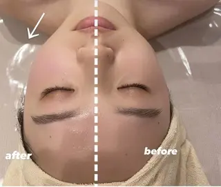 小顔専門サロン ECXIA【小顔コルギ/ボディリンパ】所属・小顔専門サロン ECXIAのエステ・リラクイメージ