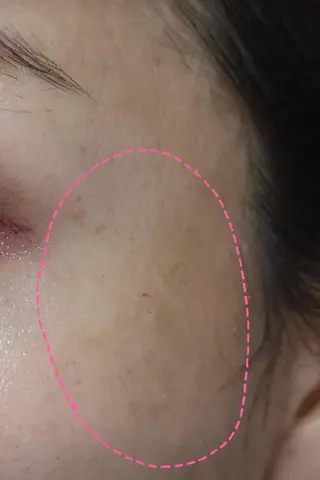 🅖🅤🅩🅔🅛 salonのエステ・リラクイメージ