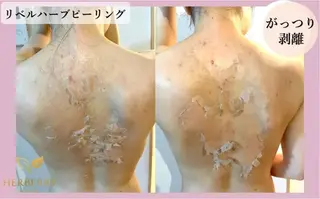 ハーブピーリング専門店HERBERRY難波心斎橋店所属・ハーブピーリング専門 HERBERRY冨永のエステ・リラクイメージ