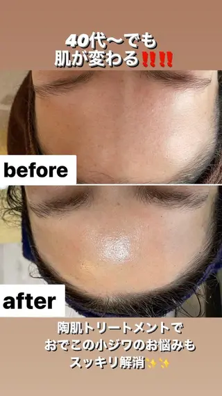 アロマ•ピーリング SalonYokoのその他イメージ