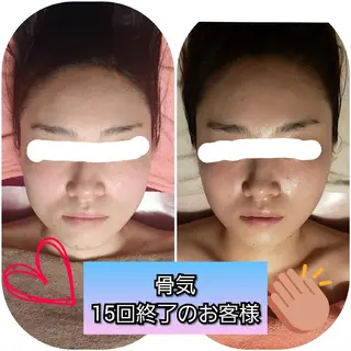 毛穴ケア くすみ肌 ハーブピーリングのエステ・リラクイメージ