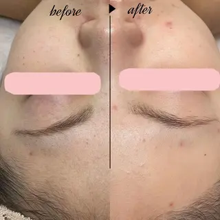 🌿小顔・痩身・脱毛 レイビス川崎店🌿のエステ・リラクイメージ