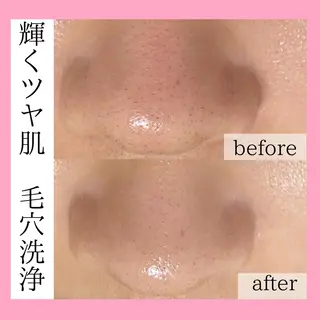 てらもと ほのかのエステ・リラクイメージ