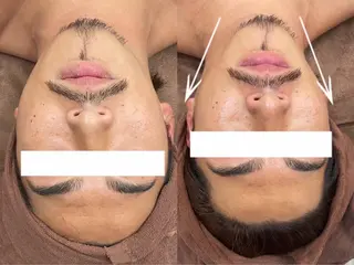 脱毛＆シェービング専門店　心斎橋所属・脱毛＆シェービング 専門店LUANAのエステ・リラクイメージ