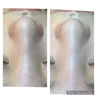 ニキビ/肌質改善専門 Snow skinのエステ・リラクイメージ