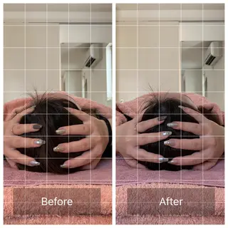 【頭痛、睡眠改善】 salon RUUのエステ・リラクイメージ