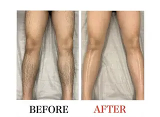 メンズ メンズ・ブリリアンス メンズ専用脱毛サロンのエステ・リラクイメージ