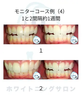 セミロング カラー ホワイトニングサロン nico西葛西店のその他イメージ