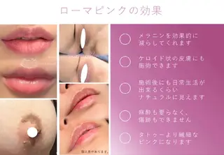 医療提携サロン新宿 La Lunaのエステ・リラクイメージ