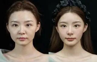 ネイル aliaハイフ&水光ジェットサロン所属・aliaハーブ水光店 エステティシャン募集のエステ・リラクイメージ