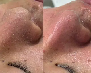 山上 留衣の眉毛・アイブロウイメージ