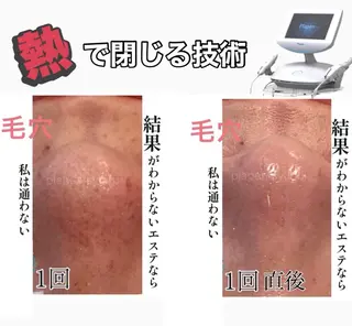 Lumiere despoir所属・Lumiere despoirのエステ・リラクイメージ