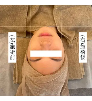 小顔/たるみ/黒ずみ除去専門サロン/SONA 大和西大寺店所属・【小顔専門看護師 サロンSONA】のエステ・リラクイメージ