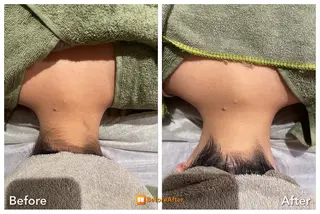 Meupニキビ専門店 背中/ハーブ/肌管理のその他イメージ