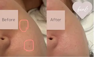 べアール所属・小顔/毛穴/ニキビ salon bealのエステ・リラクイメージ