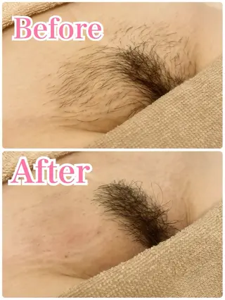 カラー シュガーリング脱毛 専門店Ranunのエステ・リラクイメージ