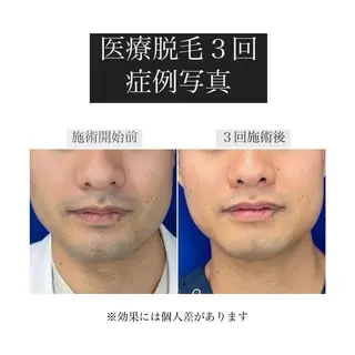 BITSU　PRESS原宿所属・PRESS 中山のエステ・リラクイメージ