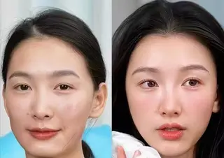 ネイル aliaハイフ&水光ジェットサロン所属・aliaハーブ水光店 エステティシャン募集のエステ・リラクイメージ