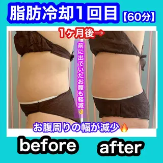 痩身/脱毛/ネイル HARUKAのエステ・リラクイメージ