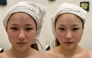 ネイル aliaハイフ&水光ジェットサロン所属・aliaハーブ水光店 エステティシャン募集のエステ・リラクイメージ