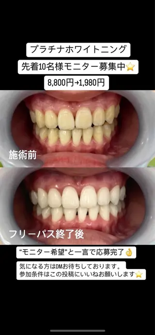 セルフホワイトニング　アデル所属・戸嶋 菫のエステ・リラクイメージ