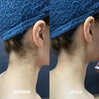 🫧美しい素肌へ🫧 今成柚乃のその他イメージ