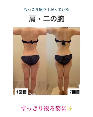 産後ダイエット−9㎏ Pourvous結衣のエステ・リラクイメージ