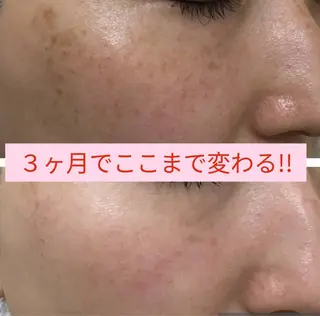 プライベートサロン LaLa 北山まいこのエステ・リラクイメージ