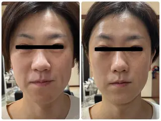 Eyelash Salon 4Uのマツエク・マツパデザイン