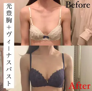 ショート カラー パーマ ヘアアレンジ メンズ キッズ ネイル マツエク・マツパ アイブロウ ヴィーナス 関内店のエステ・リラクイメージ