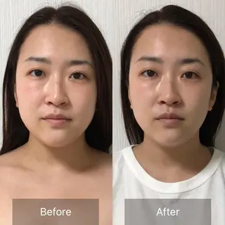 ミディアム 小顔専門 ヘッドスパ【jiu】のエステ・リラクイメージ