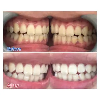 M渋谷店所属・Ｍ渋谷 ホワイトニングのエステ・リラクイメージ