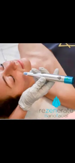 【ハーブピーリング】 Allumentのエステ・リラクイメージ