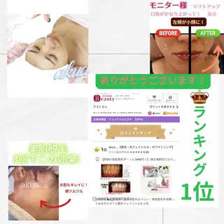 akua... 【肌質管理専門】のその他イメージ