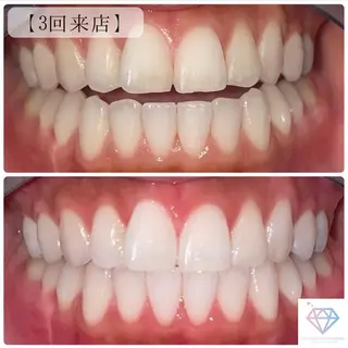 ダイヤモンドホワイトニング渋谷所属・DIAMOND BEAUYのその他イメージ