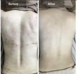 ハーブピーリング専門 COCO.梅田中津のエステ・リラクイメージ