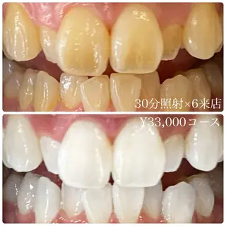 メンズ ホワイトニングルーム　川崎店所属・ホワイトニング ルーム　川崎店のその他イメージ