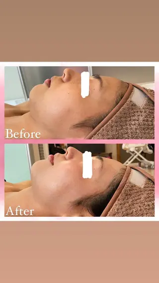 salon〜RePCa〜(サロンルピカ)所属・山﨑 藍のエステ・リラクイメージ