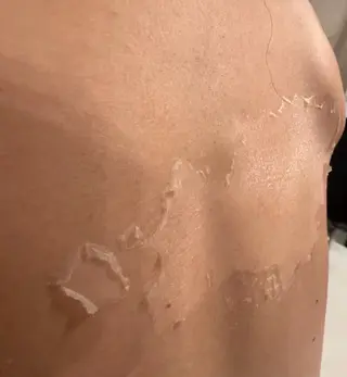 clé skin 🌿ハーブピーリングのエステ・リラクイメージ